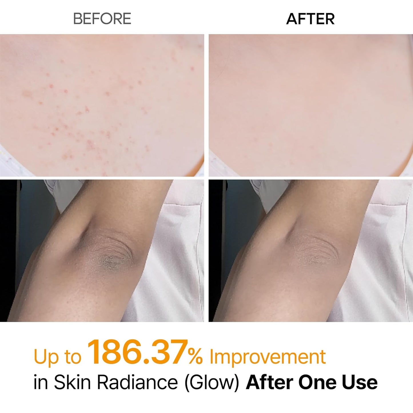 SPRAY EXFOLIANTE CORPORAL RADIANTE